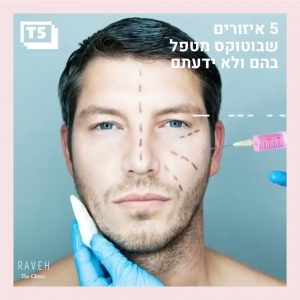 5 איזורים שבוטוקס מטפל בהם