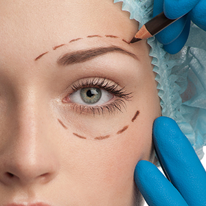 הרמת עפעפיים עליונים לעומת תחתונים