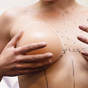 מתי מומלץ לבצע החלפת שתלים