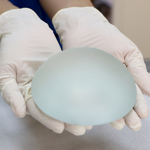 האם יש שתלים לכל החיים?