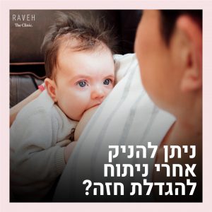 ניתן להניק אחרי הניתוח? מיתוסים על הגדלת חזה