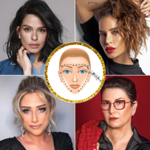 הוצאת שתלים, מתיחת פנים והצרת היקפים: הניתוחים הפלסטיים של הכוכבות